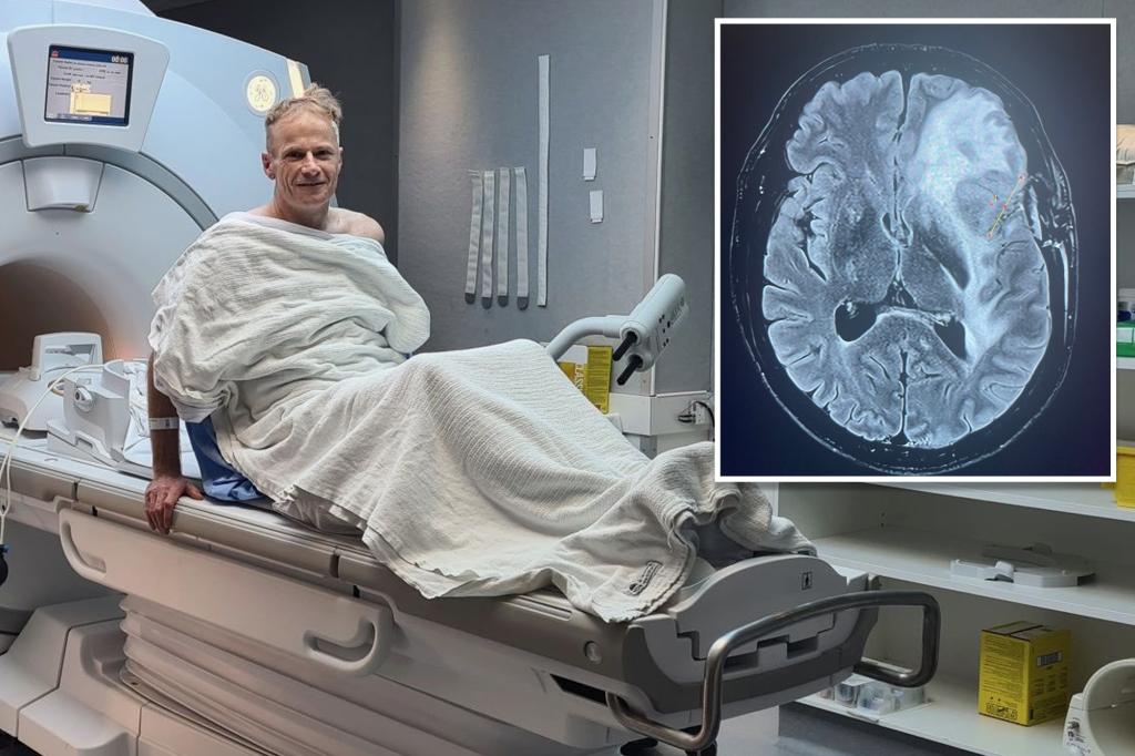 Prominent Pathologist Richard Scolyer reveals heart updating of cancer months after experimental immunotherapy