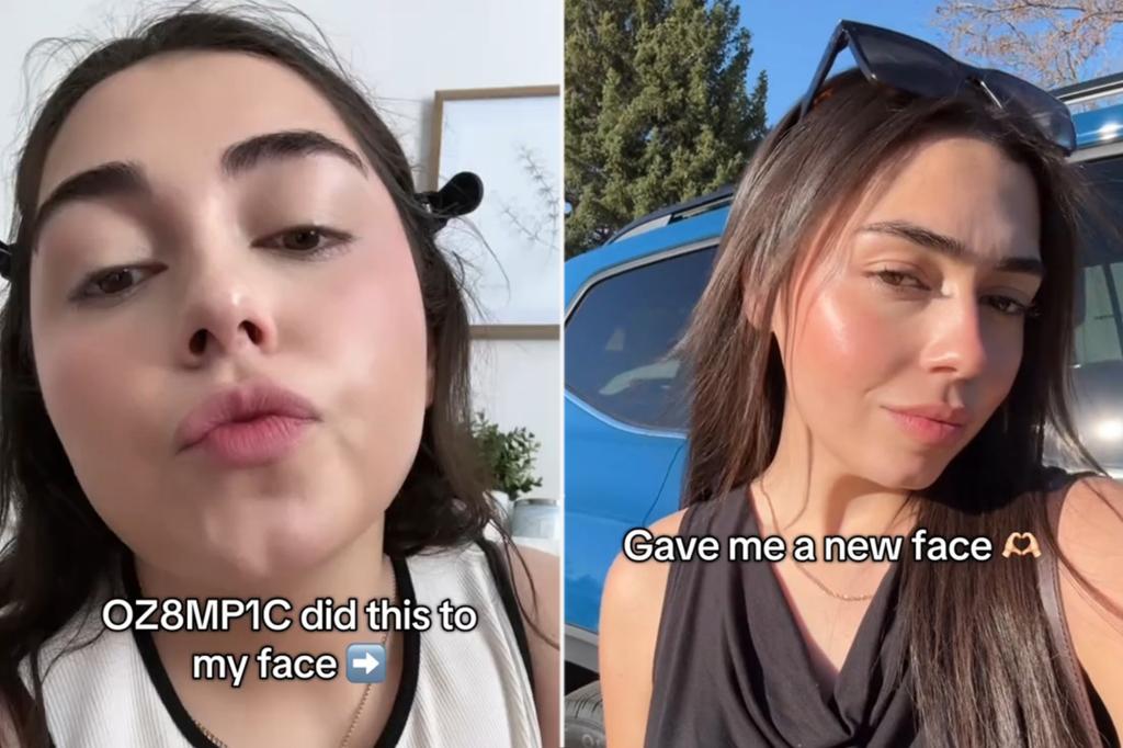'Ozempic Face' can cause saturated skin - but one user loves her new look: 'Like I have filled Jawline Fairing'