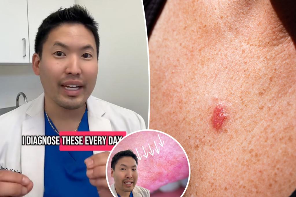 I am a dermatologist - these easily bypassed signs on your skin may indicate cancer